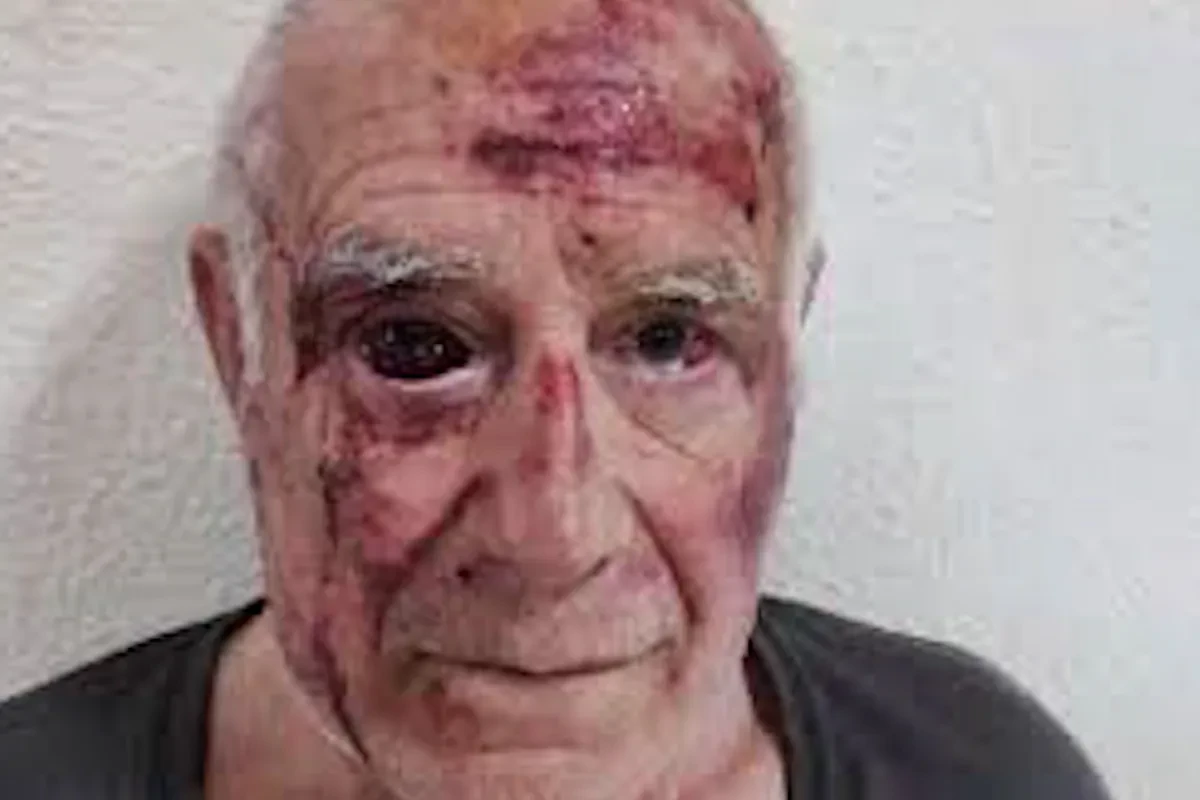 Domingo, el vecino agredido en Torre Pacheco: 