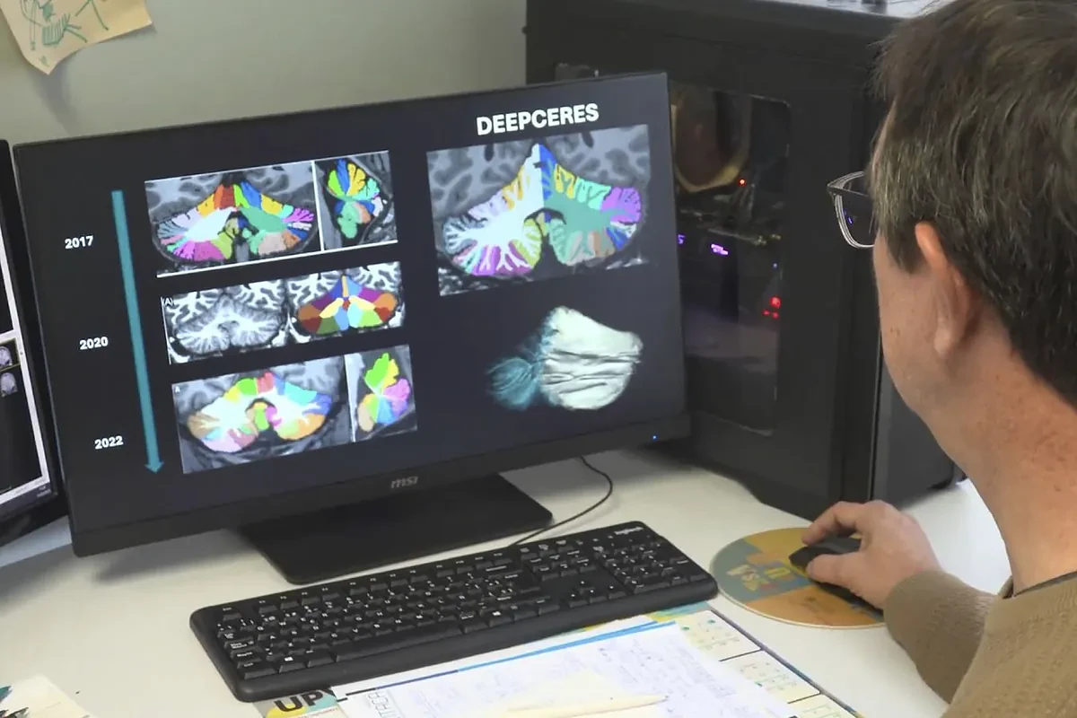 Desarrollan el 'software' más avanzado del mundo para estudiar el cerebelo: 