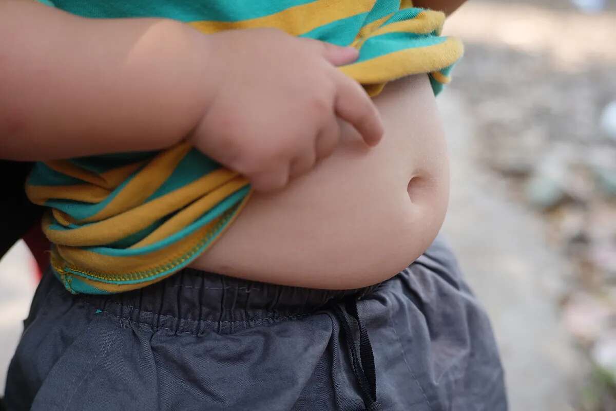 La obesidad hipoteca la salud de las nuevas generaciones: 