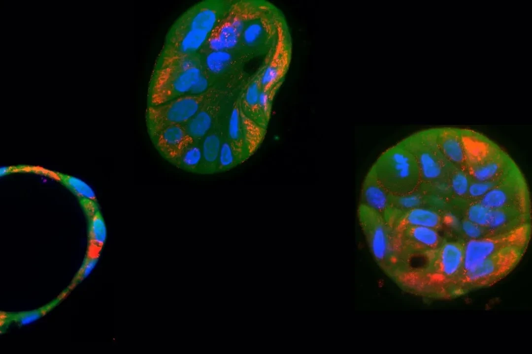 La edición genética ayuda a corregir mutaciones dañinas en el ADN mitocondrial humano