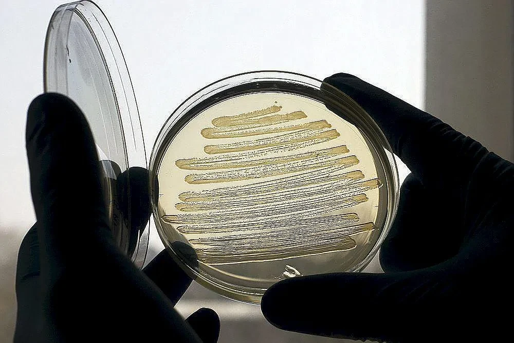 Primer caso de producción de paracetamol a partir de la bacteria 'Escherichia coli' utilizando una botella de plástico