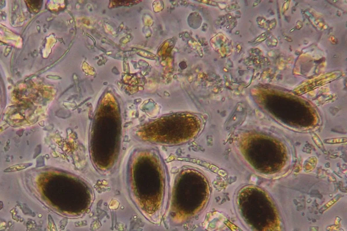 Hallan nuevas microalgas potencialmente tóxicas en la costa mediterránea de la Región de Murcia