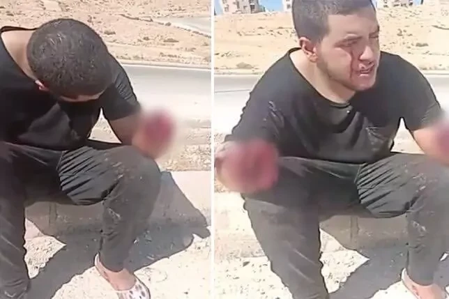 La brutal tortura a un menor que conmociona a Jordania: le amputaron las manos y le sacaron un ojo
