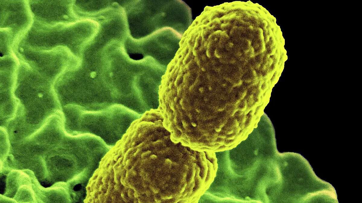 La amenaza global de las 'superbacterias': si no se revierte la tendencia causarán 39 millones de muertes antes de 2050