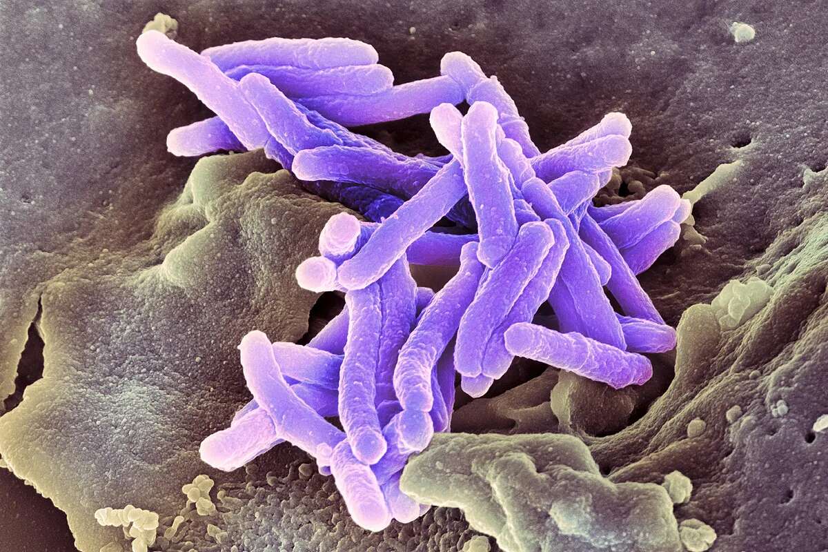 Extremadura activa la vigilancia epidemiológica tras confirmarse tres positivos tras un caso de tuberculosis en un colegio de Badajoz