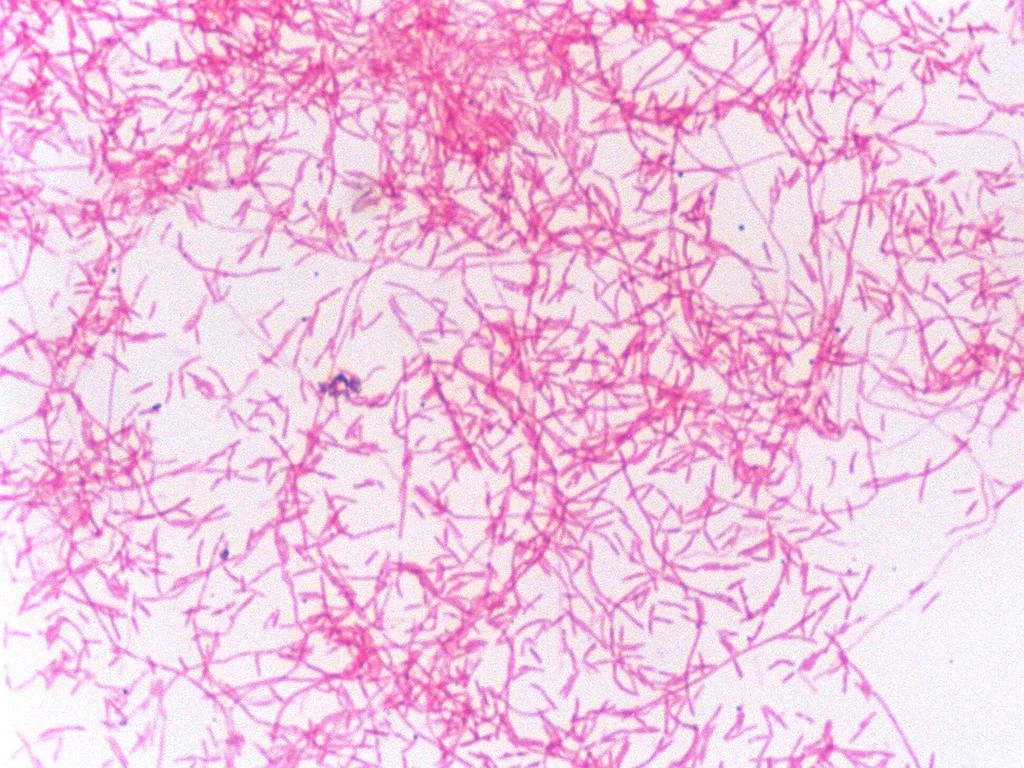 Urgent alert for Legionnaires outbreak