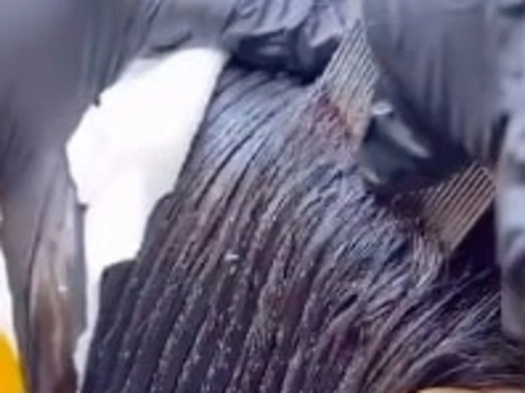 Shock clip of girl with millions of head lice