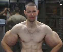 Chciał być jak Popeye. Walczy o życie