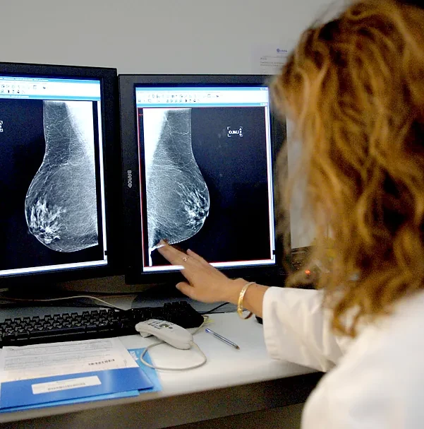 Sanidad aprueba la ampliación del cribado de cáncer de mama a mujeres de entre 45 y 74 años