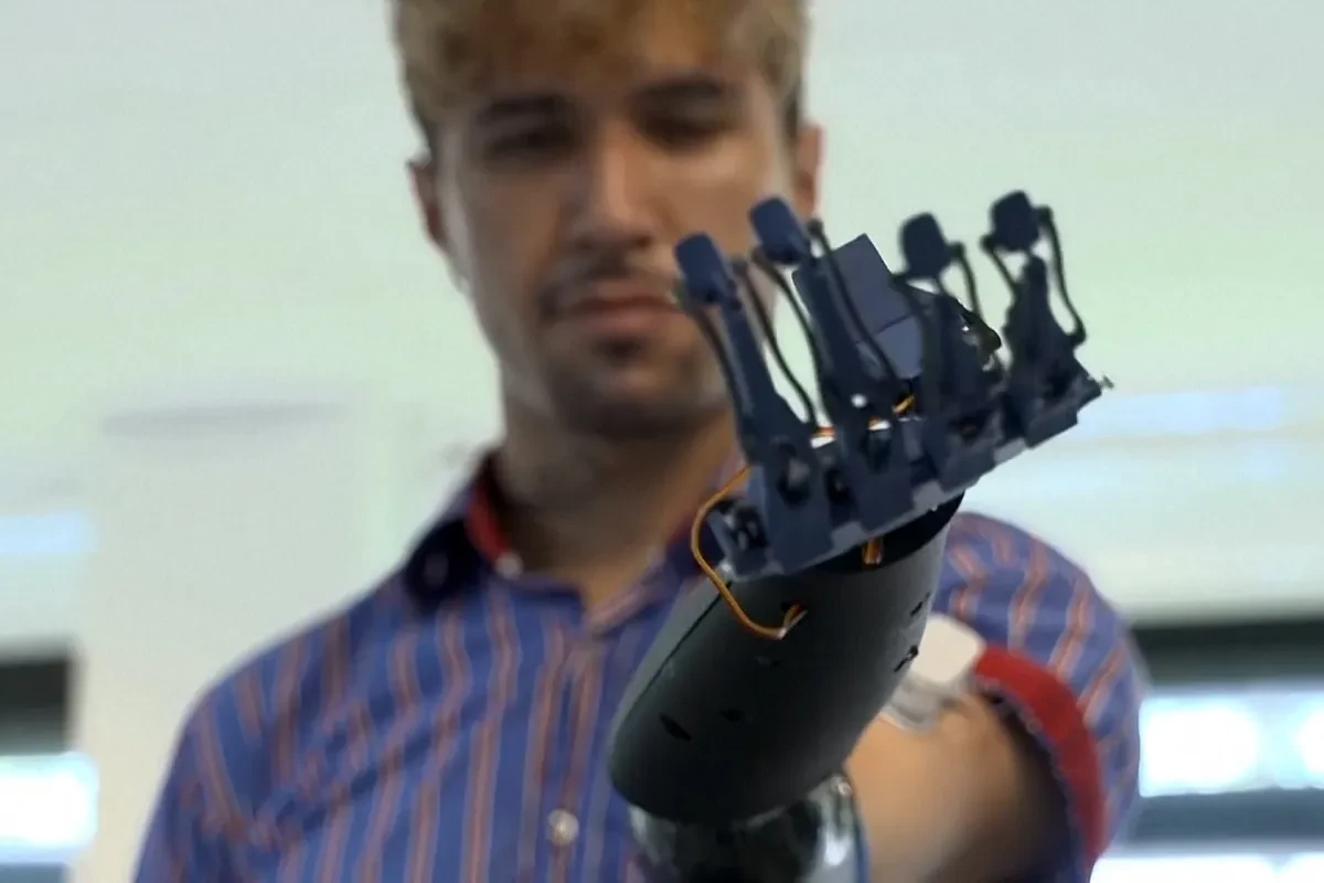 Así es la prótesis E-Redi: biónica, sencilla y fácil de usar. ¿El futuro de gadgets biónicos?