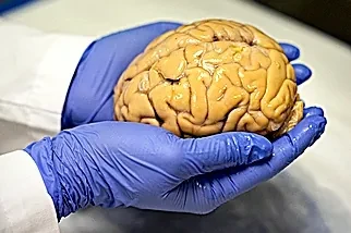 Test de alzhéimer en sangre: más cerca de la detección antes de que aparezcan los síntomas