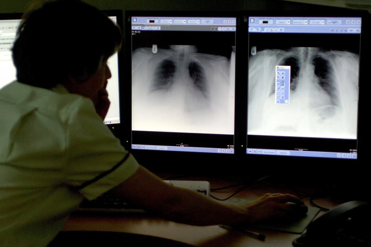 AI tools to improve health could put people at risk, doctors warn
