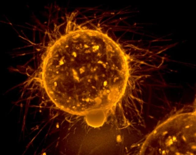 Cancer cells suck mitochondria out of immune cells using tiny tubes