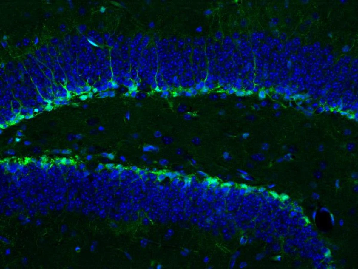 Study could lead to injections replicating brain benefits of exercise