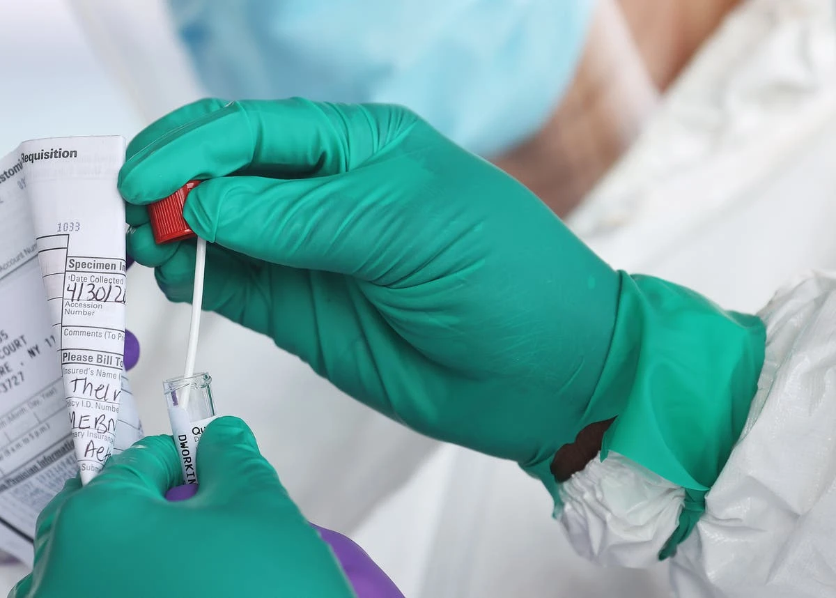 Longest known ‘extreme’ Covid infection seen in 72-year-old man