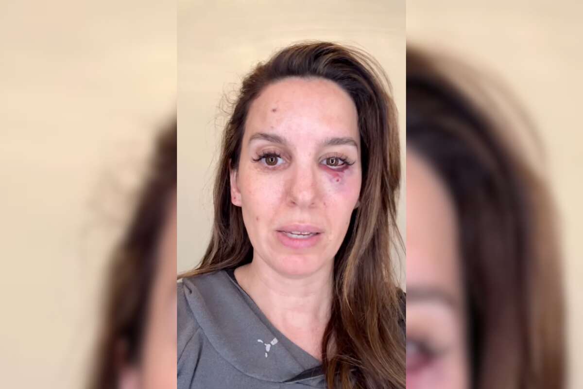 Ex-Disney star shot in the face during husband’s birthday