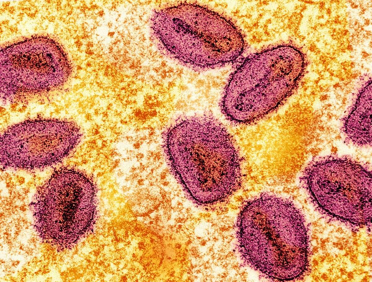 India confirms first case of mpox clade 1b that sparked global warning