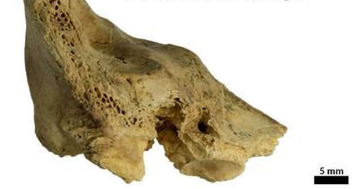 First Neanderthals Down Syndrome fossil shows their compassionate side