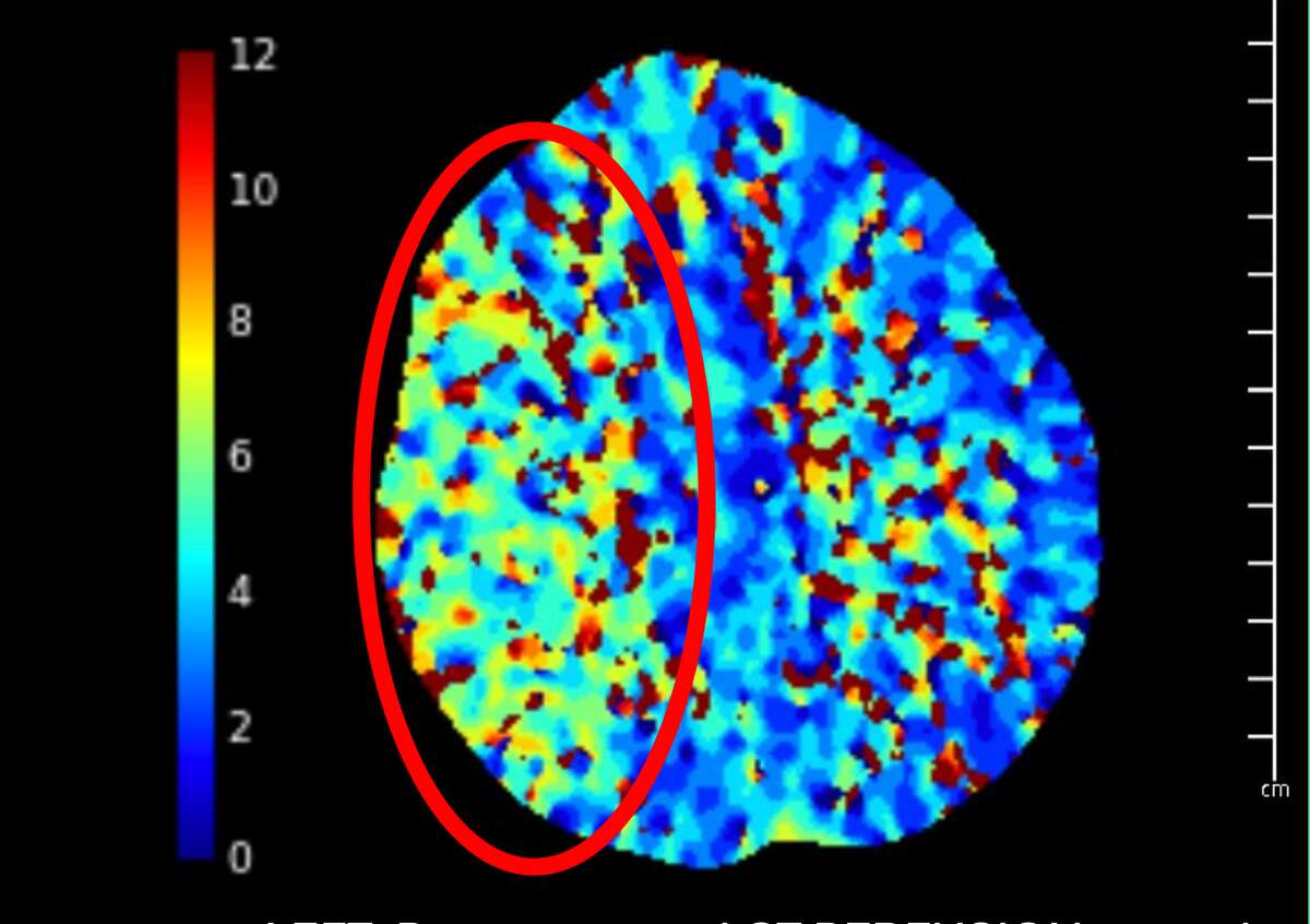 Man sues Kardashian-endorsed MRI company for missing stroke signs