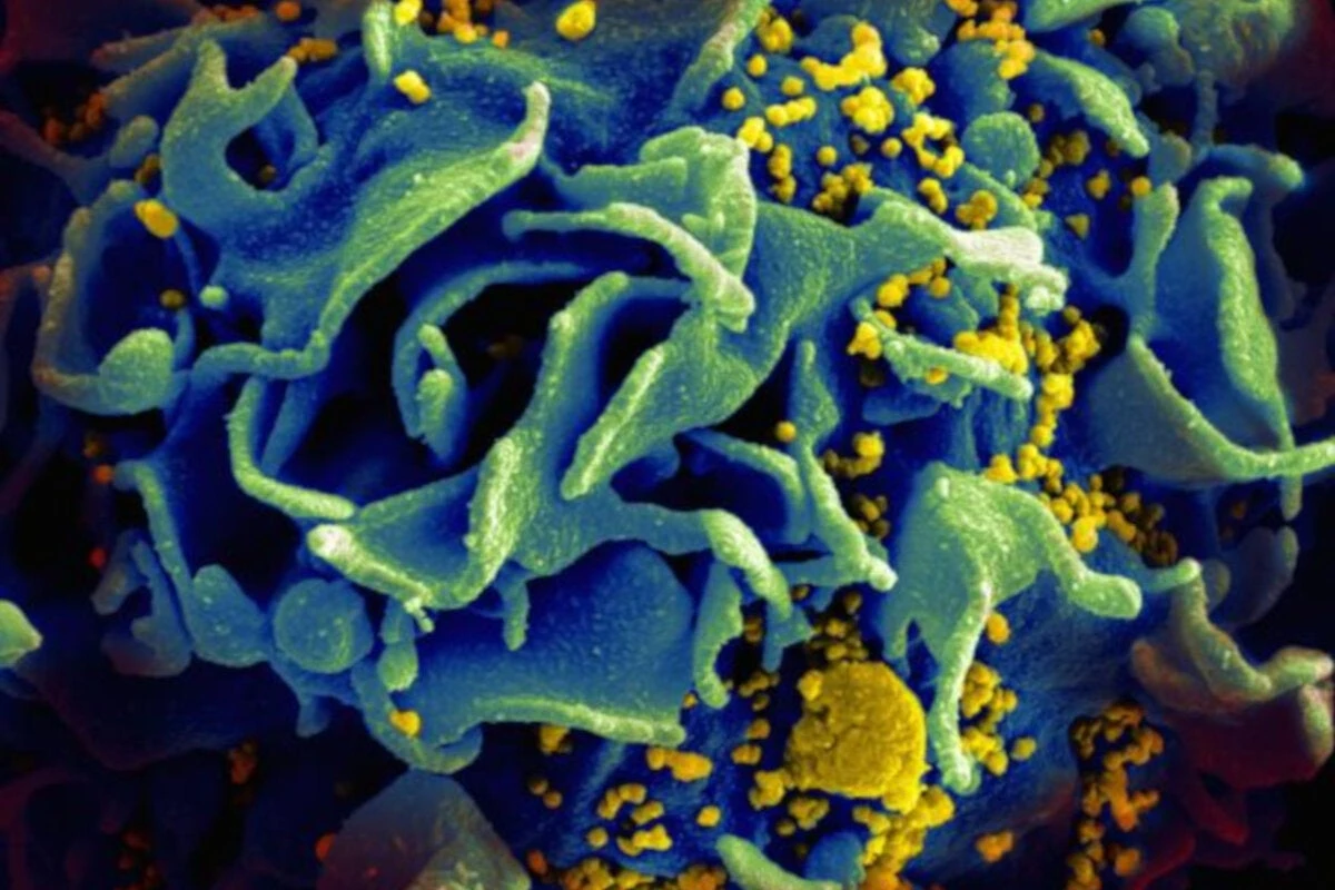 Man ‘cured’ of HIV after brother found to carry rare genetic mutation