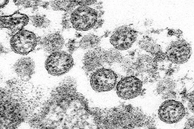 New research suggests when very first Covid case happened