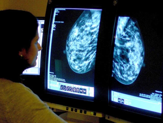 10,000 fewer patients began breast cancer treatment over past year