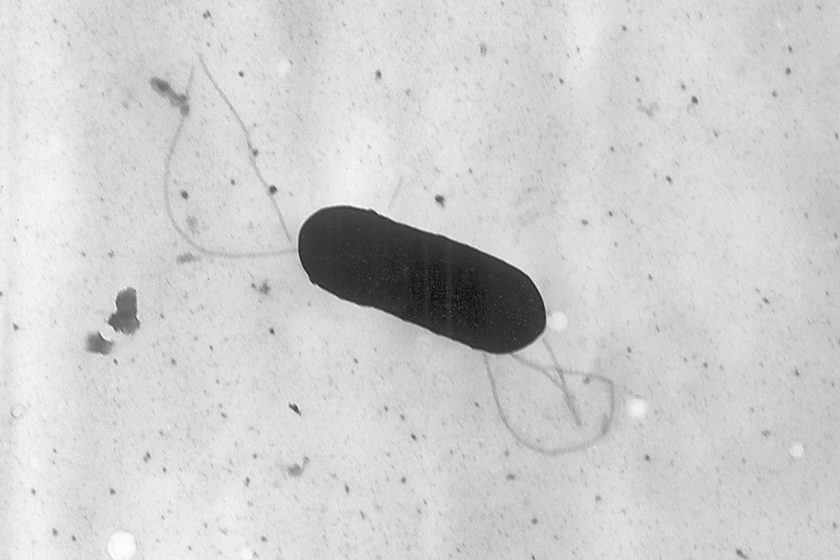 Listeria outbreak linked to prepared foods hospitalizes 10 people