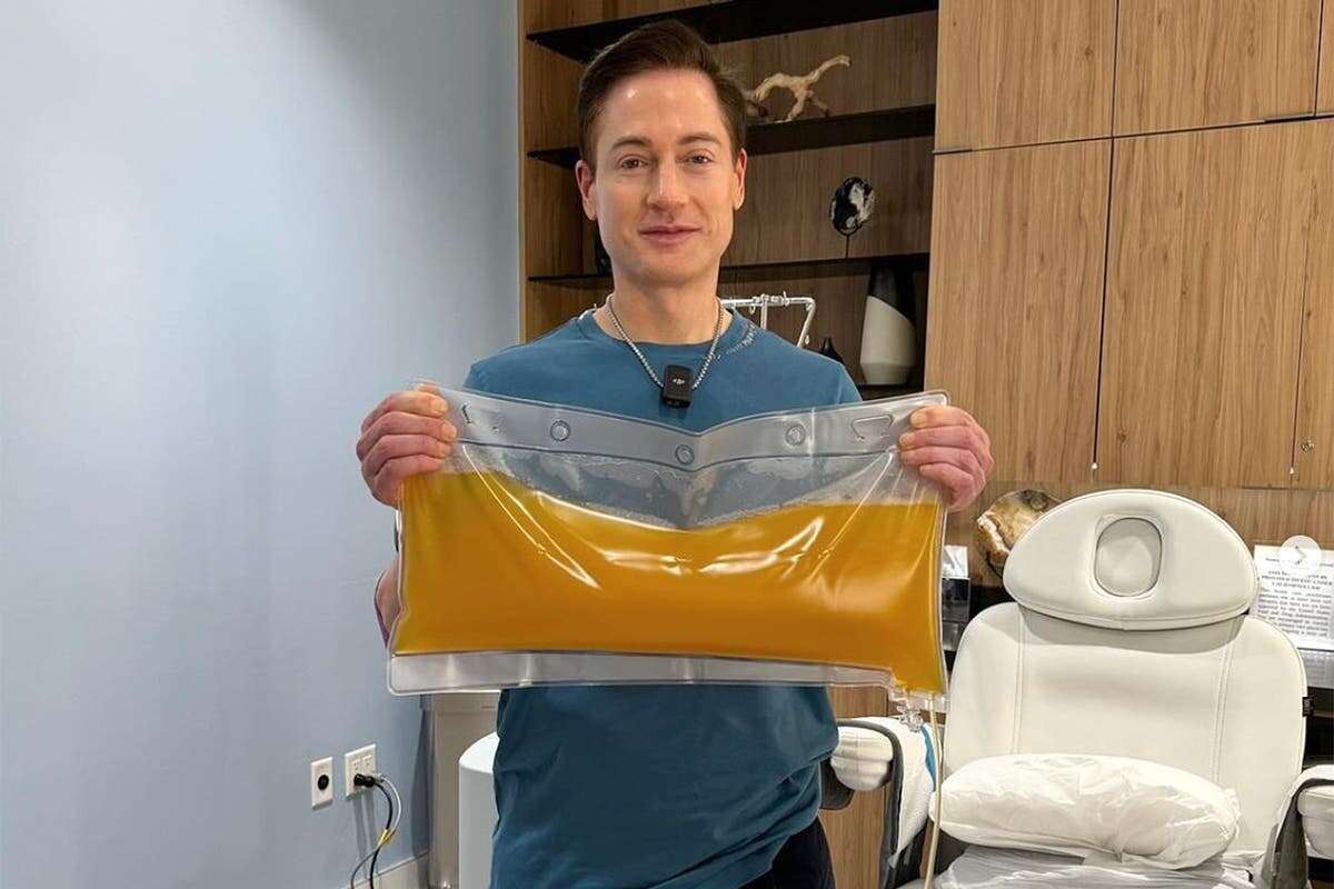 Multimillionaire biohacker replaces the ‘liquid gold’ in his body