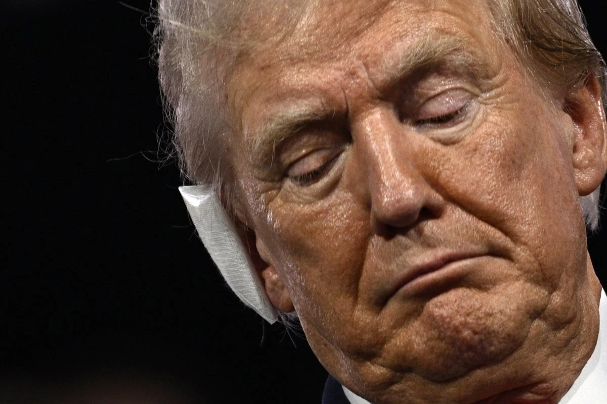 Trump confessed ear injury wasn’t ‘too bad’ at RNC despite ear bandage