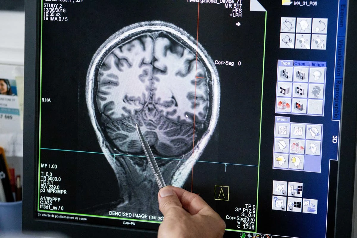Coma patients may experience fleeting consciousness right before death