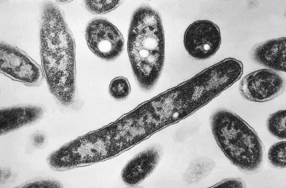 Scientists study what eats us after we die to solve future murders