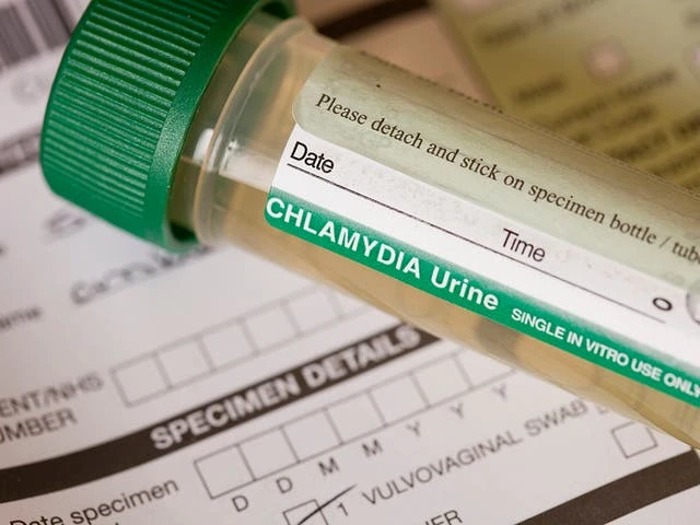 Decision to only test women and girls for chlamydia is ‘disaster’