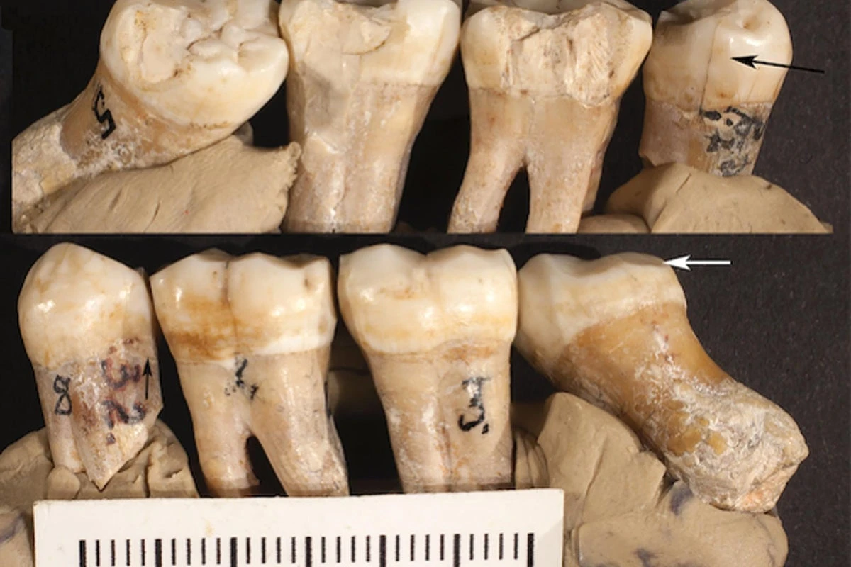 Large fossil study challenges long-held idea about human evolution