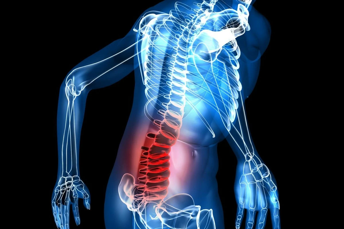 Just one course of psychotherapy can ease back pain for years