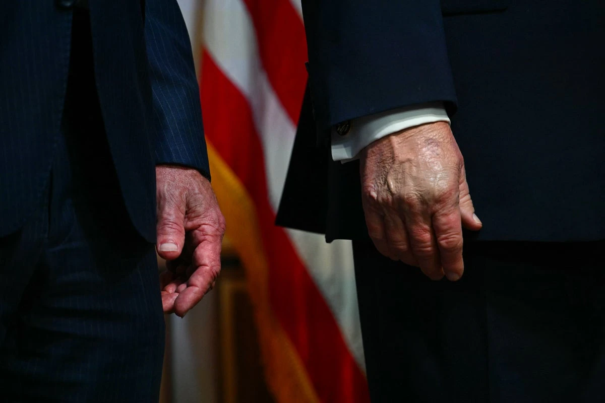 RFK Jr debuts his own hand bruise to match Trump’s