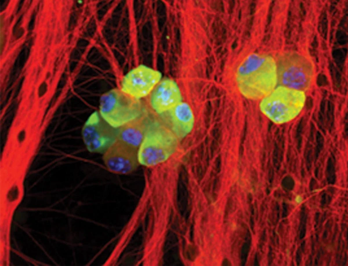 Herpes infection may double dementia risk in older adults