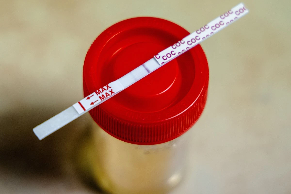 Breakthrough urine test could soon help diagnose common cancer