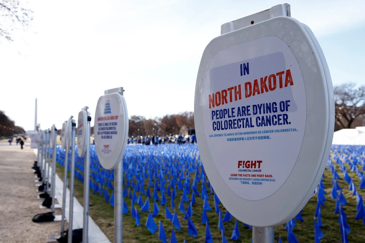 Colon cancer rates are rising in Americans under 50. Is this why?
