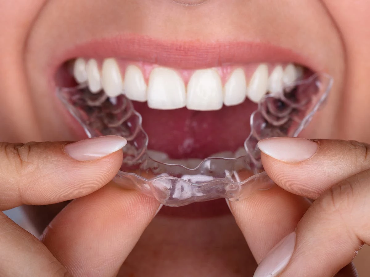 SmileDirectClub ‘left people with crooked teeth’ after firm collapse