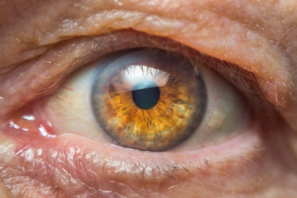 ‘Tooth-in-eye’ surgery enables man to see again after 20 years