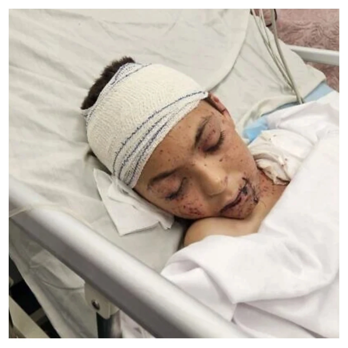 Child survivor of Israeli airstrike in Gaza flown to Italy for urgent medical treatment