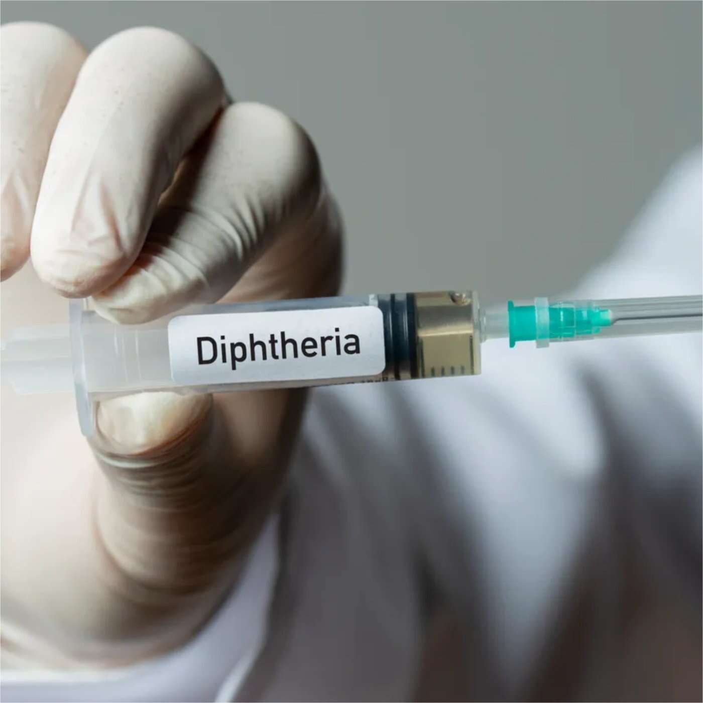 41,000 cases of diphtheria recorded – NCDC