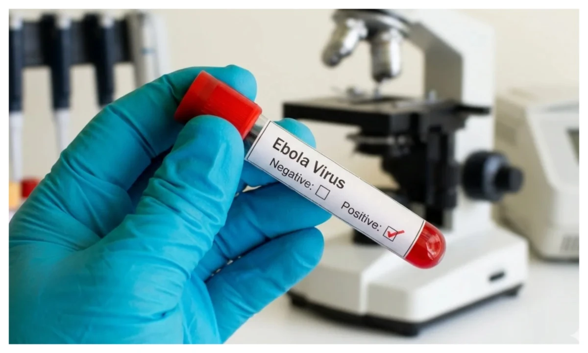Ebola can be mistaken for malaria — Medical expert