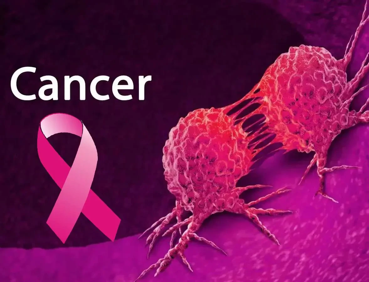 Sugary drinks, refined carbohydrates, processed meats, major causes of cancer – Varsity Don