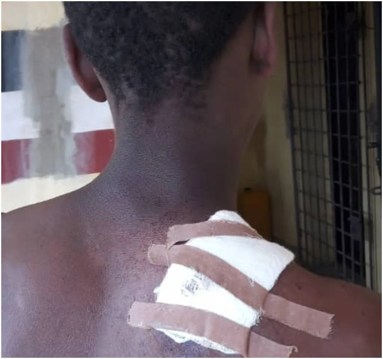 Farmer arrested for macheting Fulani herder over alleged theft of guinea fowl eggs