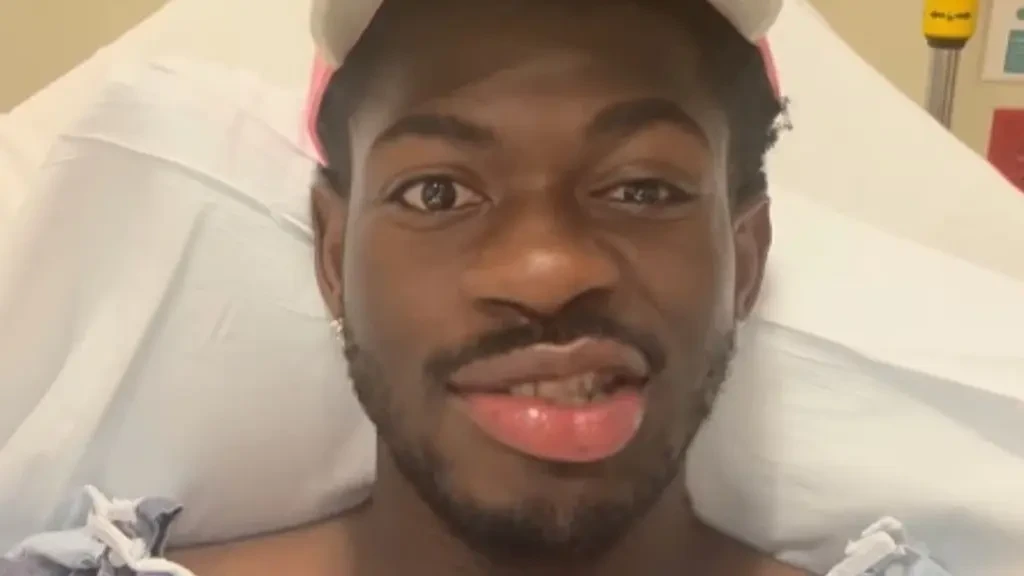 Lil Nas X reveals one side of his face is paralyzed