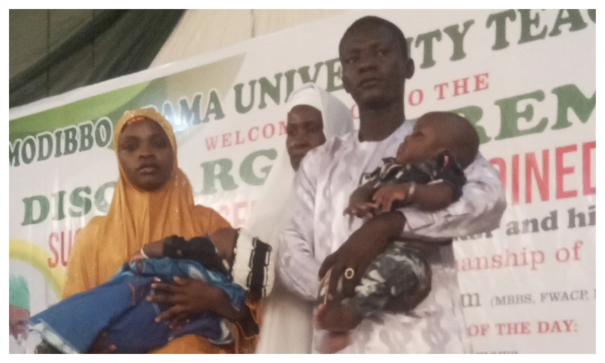 MAUTH Yola discharges successfully separated conjoined twins