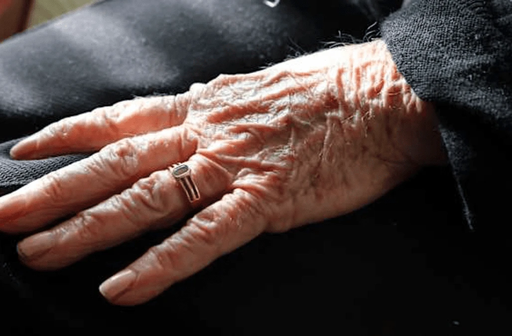 Thousands more dying at home with dementia, cancer and heart conditions