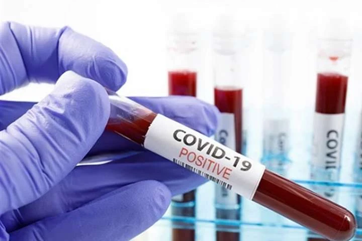 Коронавірус все ближче. Як українцям роблять аналізи на Covid-19