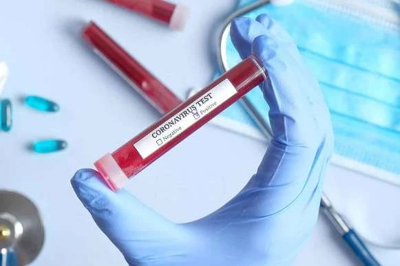 Три області і Київ лідирують за приростом випадків Covid-19: дані з усіх регіонів